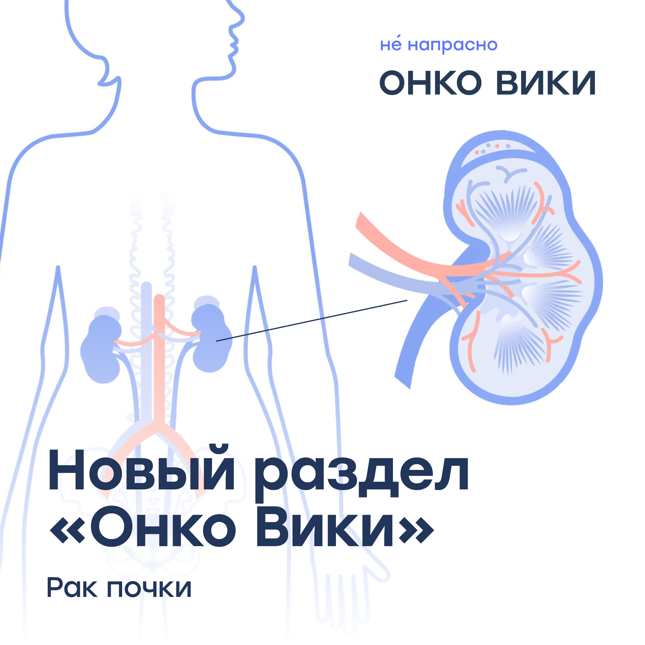 У мужчин в 1,5-2 раза чаще, чем у женщин: команда онлайн-энциклопедии «Онко Вики» выпустила новый справочник, на этот раз — о раке почки